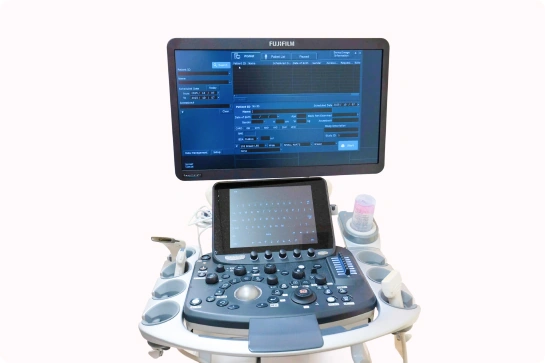 超音波診断装置（TOSHIBA Aplio300）