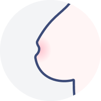 乳頭の陥没や形の変化